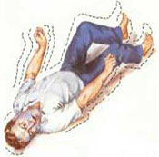 西安哪家医院治肌阵挛癫痫病 西安哪家医院治肌阵挛癫痫病